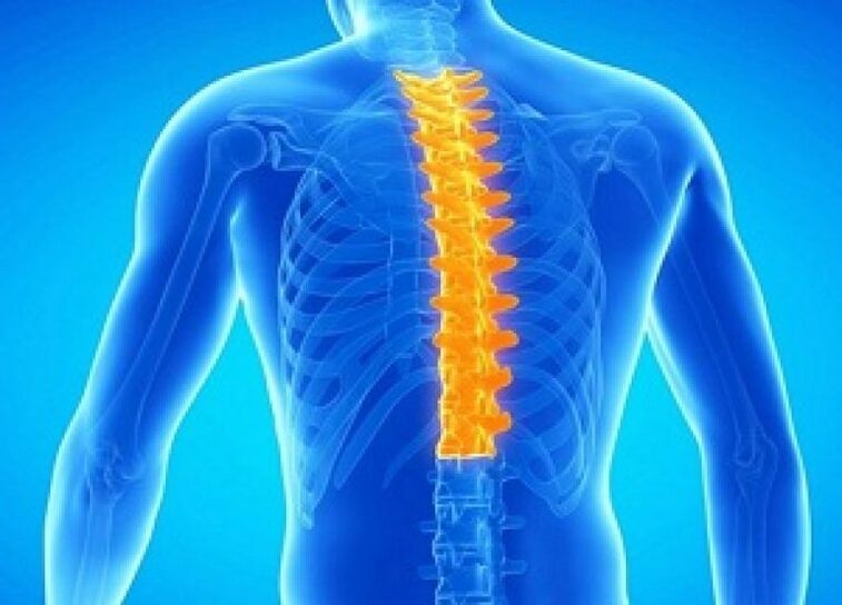 Krūšu mugurkaula osteohondroze