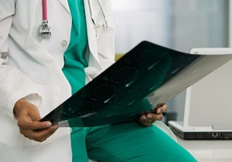 Rentgens palīdzēs ārstam diagnosticēt mugurkaula krūšu osteohondrozi