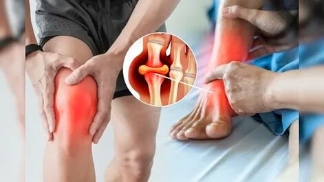 Ādas zonas, kas piemērotas Icexin gēla uzklāšanai (ceļi, elkoņi, muguras lejasdaļa)